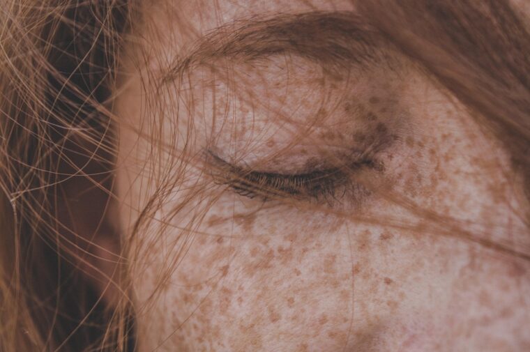 woman, freckles, red hair, eye, eyelid, hair, redhead, model, girl, beauty, closeup, freckles, freckles, freckles, freckles, freckles, red hair, red hair, hair, hair, redhead-4541897.jpg